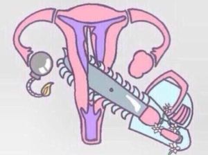 9979de2eef5e42f7bd750de06c27d7da